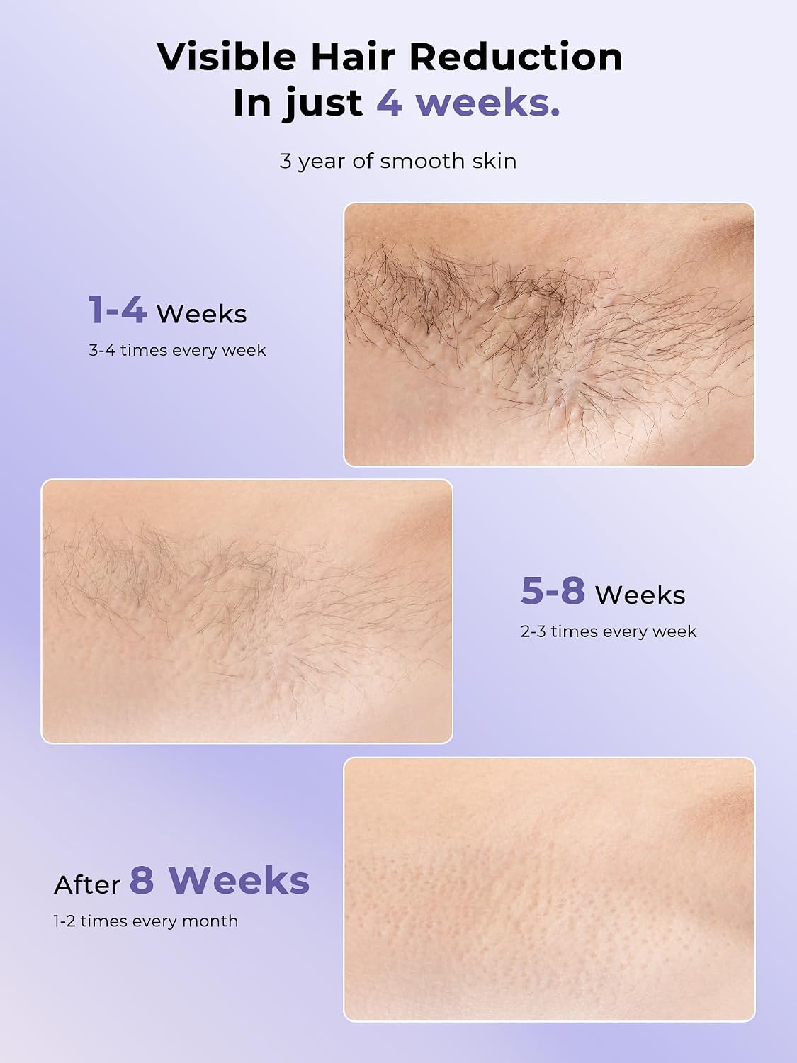 Ubroo Laser Hair Removal for Women, 97.6% Hair Reduction in 2 Session, 5℃ Ice Cooling IPL Hair Removal Device, Hair Removal at Home for Legs Bikini Armpits Facial (Purple)